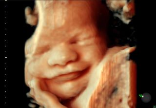 3D ultrasound baby smiling