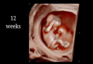 12 Weeks