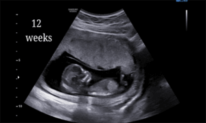 12 Weeks