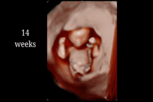 14 Weeks