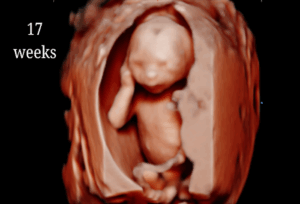 17 Weeks