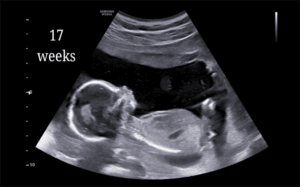 17 Weeks