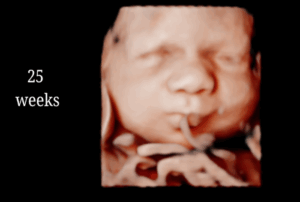 25 Weeks