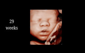 29 Weeks