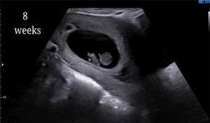 8 Weeks
