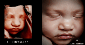 8k Image Enhancement