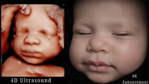 8k Image Enhancement
